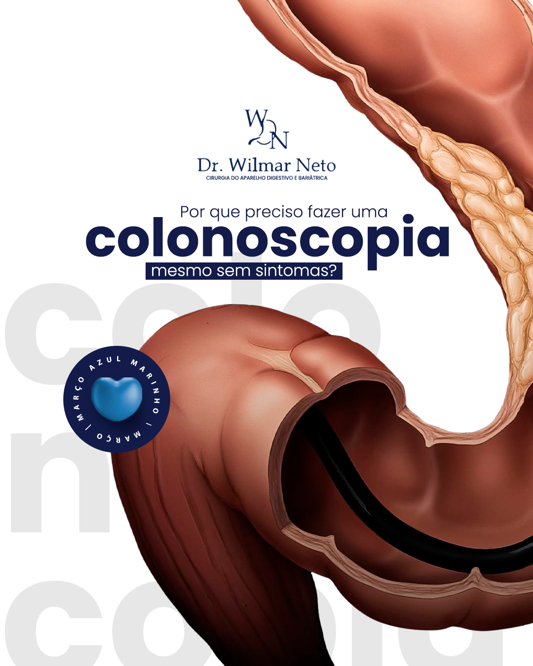 Coloroscopia Colonoscopia – Dr. Wilmar Neto